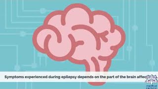 Absence seizure  Types of seizures  Epilepsy [upl. by Jessee332]