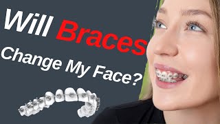 Will Braces Change My Face  Dentist Explained 2021 [upl. by Vookles112]