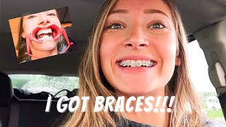 FINALLY GETTING BRACES ON VLOG 2023 [upl. by Reitman]