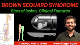 Brown Sequard Syndrome  Physiology  Hemisection of Spinal Cord  CNS Physiology Video [upl. by Krystin]