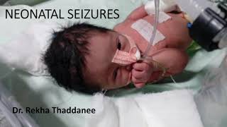 Neonatal Seizures  Pediatrics [upl. by Gunning498]